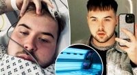 Tanning addict given nightmare diagnosis after hitting beds up to five times a week