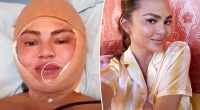 Chrissy Teigen sparks concern with shocking photo of bandaged face