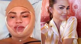 Chrissy Teigen sparks concern with shocking photo of bandaged face