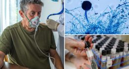 Dangerous fungus could spread to parts of US, researchers claim
