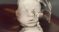 A Kentucky woman prayed for her baby's health during an ultrasound appointment and was moved to tears when an image appeared to show 'the hand of God' on her child's head