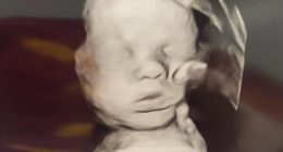 A Kentucky woman prayed for her baby's health during an ultrasound appointment and was moved to tears when an image appeared to show 'the hand of God' on her child's head