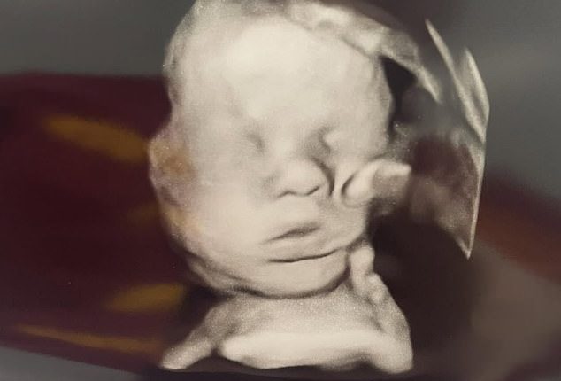 A Kentucky woman prayed for her baby's health during an ultrasound appointment and was moved to tears when an image appeared to show 'the hand of God' on her child's head