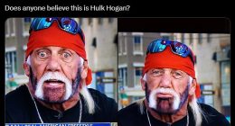 Hulk Hogan's horrifying new look on Fox News sparks viewers' concern