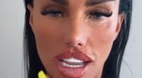 Katie Price reveals the results of her HUGE ‘Butterfly’ lips after getting MORE filler