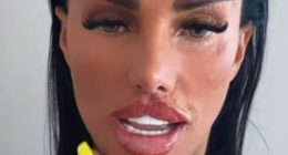 Katie Price reveals the results of her HUGE ‘Butterfly’ lips after getting MORE filler