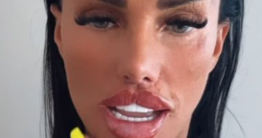 Katie Price reveals the results of her HUGE ‘Butterfly’ lips after getting MORE filler