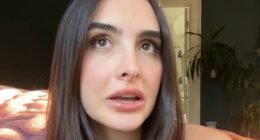 Kyle Richards’ daughter, 25, reveals her hair is falling out after taking weight loss drug saying ‘I’m gonna be bald!’