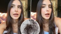 Kyle Richards’ daughter Sophia, 25, reveals shock hair loss after taking weight-loss drug: ‘I’m gonna be bald’