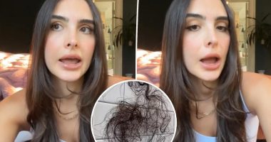 Kyle Richards’ daughter Sophia, 25, reveals shock hair loss after taking weight-loss drug: ‘I’m gonna be bald’
