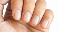 Telltale signs of finger clubbing include softening of the nail, red and shiny skin around the nail and ridges along the length of it, according to Cancer Research UK