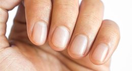 Telltale signs of finger clubbing include softening of the nail, red and shiny skin around the nail and ridges along the length of it, according to Cancer Research UK
