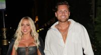 Love Island’s Casey O’Gorman forced to pull out of Tom Park charity event as he reveals nasty ankle injury