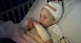 Margot McNicol (pictured) was attacked by an American Staffy on Sunday morning