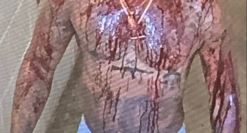Tory Lanez seen covered in blood as vid shows him being stabbed 14 times in prison after rapper shot Megan Thee Stallion