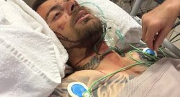 Anthony Bell, 33, is pictured in critical condition in a Perth hospital after suffering brain bleeding and 19 broken bones from 3.5m fall through a skylight
