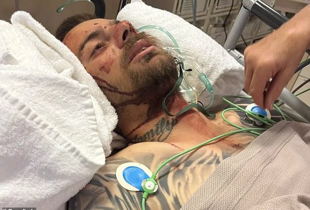 Anthony Bell, 33, is pictured in critical condition in a Perth hospital after suffering brain bleeding and 19 broken bones from 3.5m fall through a skylight