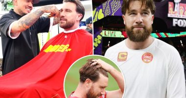 Travis Kelce’s barber reveals truth behind hair transplant rumors