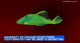 University of Chicago study finds tooth sensitivity may be linked to ancient fish