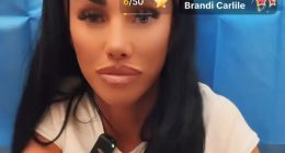 Watch as Katie Price TikTok live streams £1.5k bum filler op for shocked fans with TWO surgeons injecting BBL at once
