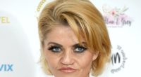 Danniella Westbrook in hospital for life changing op to rebuild her face after years of cocaine abuse