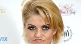 Danniella Westbrook in hospital for life changing op to rebuild her face after years of cocaine abuse