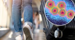 Deadly Hepatitis A outbreak infects thousands of travelers at popular European destinations