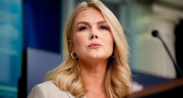 Did Karoline Leavitt Get A Nose Job? Cosmetic Expert Tells Us Giveaway