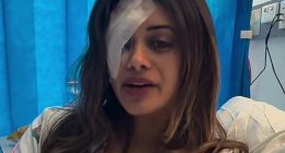 Former Greens candidate Hannah Thomas, who sustained horrific injuries to her eye during an arrest at a pro-Palestine protest on Friday, has been charged by police