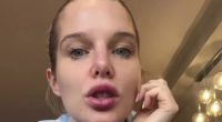 Helen Flanagan reveals scary health issue that’s left her lips ‘numb’