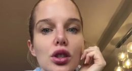Helen Flanagan reveals scary health issue that’s left her lips ‘numb’