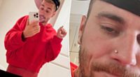 Justin Bieber fans beg him to ‘get help’ as he appears to be ‘seriously struggling’ in new photos: ‘Sad to watch’