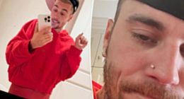 Justin Bieber fans beg him to ‘get help’ as he appears to be ‘seriously struggling’ in new photos: ‘Sad to watch’