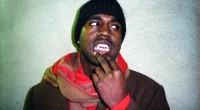 Kanye ‘Ye’ West Titanium Teeth Didn’t Cost Anywhere Near What Rapper Claimed to Pay, Dentist Says