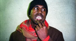 Kanye ‘Ye’ West Titanium Teeth Didn’t Cost Anywhere Near What Rapper Claimed to Pay, Dentist Says