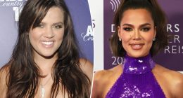 Khloé Kardashian breaks down every cosmetic procedure and surgery she’s had done, from nose job to salmon sperm facial
