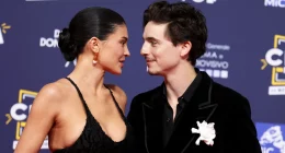 Kylie Jenner’s Romance With Timothée Chalamet Makes Her Want More Cosmetic Enhancements, Source Says