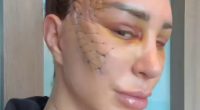 Reality star leaves fans horrified as she reveals result of extreme surgery and they beg her ‘get therapy’