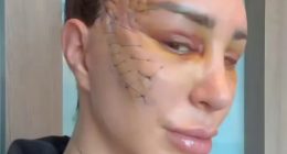 Reality star leaves fans horrified as she reveals result of extreme surgery and they beg her ‘get therapy’