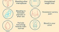 Womb cancer affects around 9,7000 women every year in the UK. Nicknamed a silent killer, when the disease is diagnosed at later stages, only 15 per cent of women will survive. Peaches Trust wants to raise better awareness for the disease, so women can catch it early