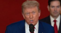 Trump's Hair Can't Hide Bald Spots Anymore & His Bright Scalp Is Nightmare-Worthy