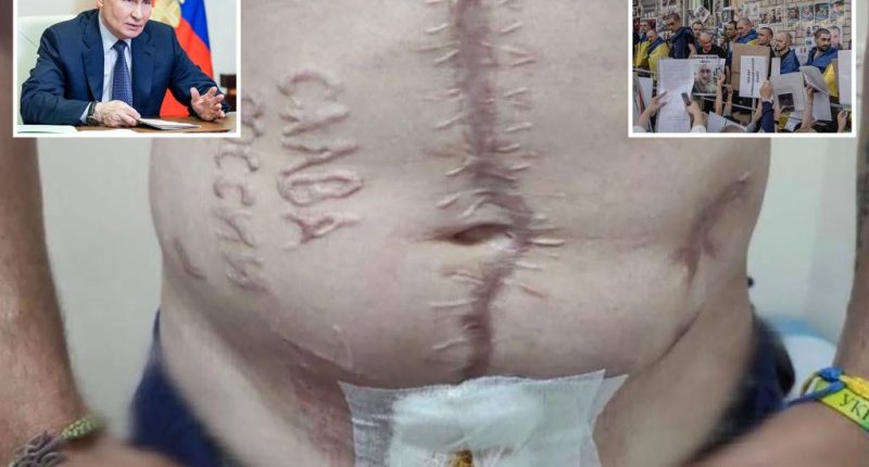 Ukrainian soldier branded with ‘Glory to Russia’ burned on his skin while in Russian captivity