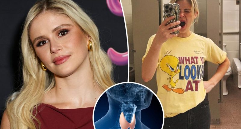 What is Graves’ disease? All about ‘The Boys’ star Erin Moriarty’s diagnosis