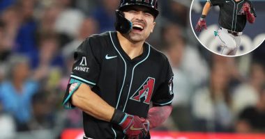 ‘Confusing’ injury sends Diamondbacks’ Corbin Carroll to IL after X-ray fiasco