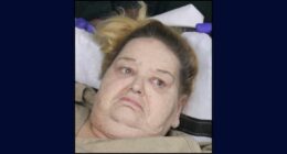 'Opened her mouth as if she was going to bite me': 500-pound woman calls cops for help, then attacks them while being stretchered out of home, police say
