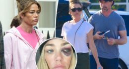 Denise Richards reveals the ‘degrading profanities’ Aaron Phypers said as he ‘repeatedly’ hit her in explosive final fight