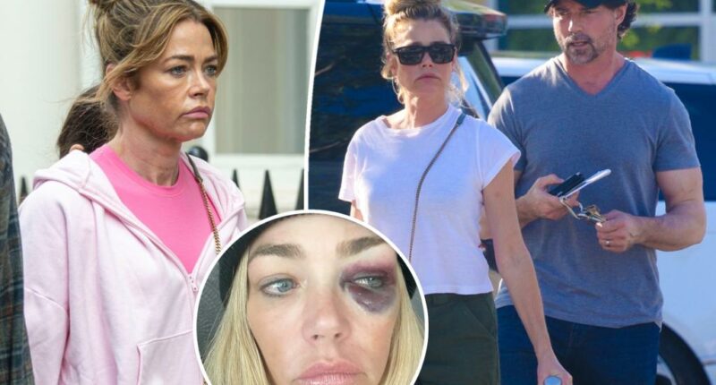 Denise Richards reveals the ‘degrading profanities’ Aaron Phypers said as he ‘repeatedly’ hit her in explosive final fight