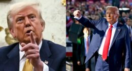 Donald Trump diagnosed with chronic venous insufficiency