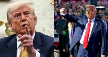 Donald Trump diagnosed with chronic venous insufficiency