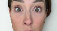 A nurse who got Botox injected on only one side of her face to show others how it really affects your looks has revealed the shocking results. She's seen before getting the Botox